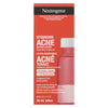 NEUTRO STUBRN ACNE DRY LOTION